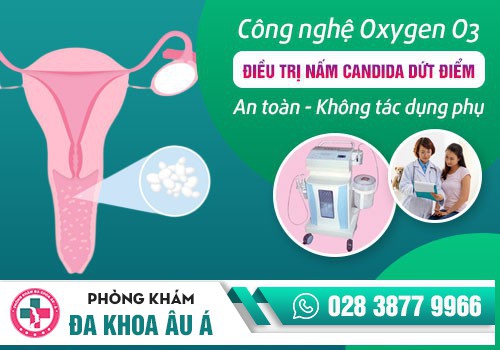 PHƯƠNG PHÁP NÀO CHỮA NẤM PHỤ KHOA HIỆU QUẢ?