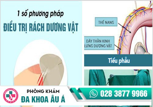 Hình ảnh điều trị rách dương vật