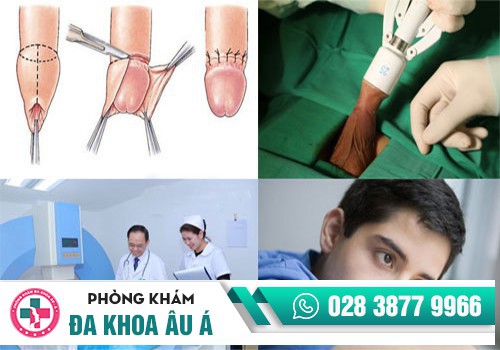 Trị sưng dương vật 