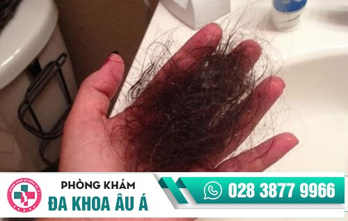 Đột phá điều trị rụng tóc bằng phương pháp hiện đại