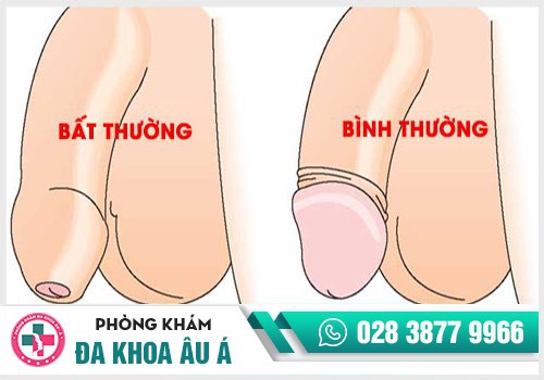 Hình ảnh dương vật bình thường