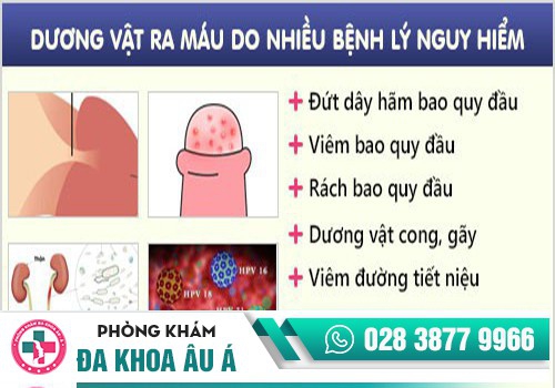 Dương vật ra máu do nhiều bệnh lý nguy hiểm