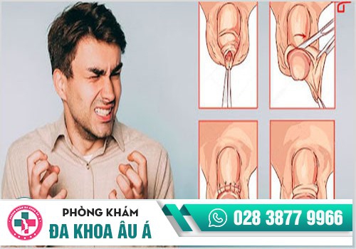  NGUYÊN NHÂN GIẢM HAM MUỐN Ở NAM GIỚI