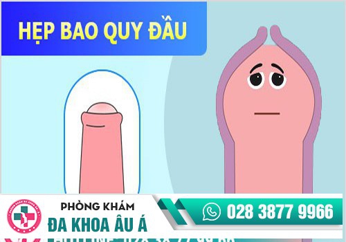 Đau dương vật sau quan hệ do hẹp bao quy đầu