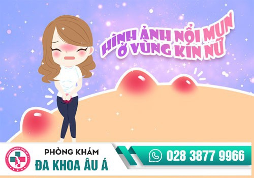 Các tình trạng bị nổi mụn ở vùng kín
