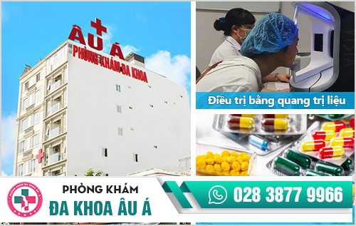 Cách chữa bệnh chàm an toàn, hiệu quả