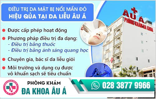 da mặt bị mẩn đỏ