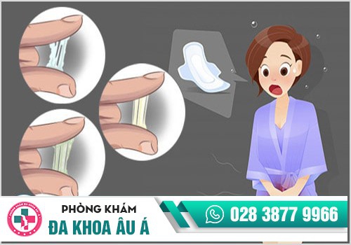 KHI NÀO HUYẾT TRẮNG ĐƯỢC GỌI LÀ BẤT THƯỜNG?