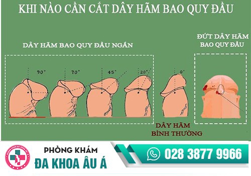 Nam giới có cần cắt dây hãm bao quy đầu không?