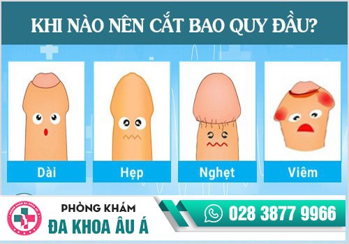 Các dạng bệnh lý cần cắt da bao quy đầu