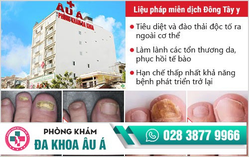 nguyên nhân gây nấm móng