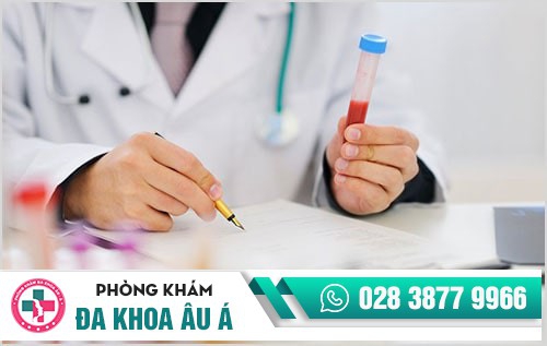 Xét nghiệm bệnh lậu ở đâu uy tín?