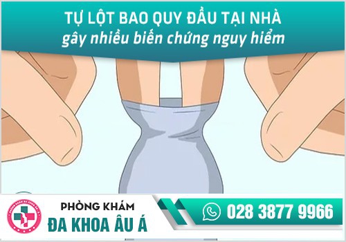 Tự lột bao quy đầu tại nhà gây nhiều biến chứng nguy hiểm