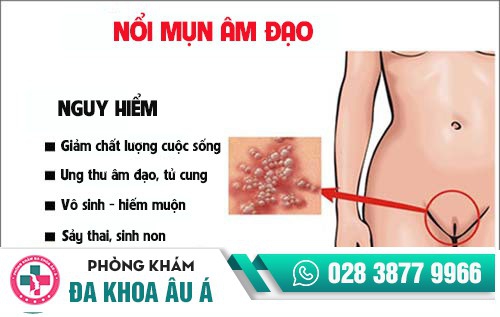 nổi mụn âm đạo