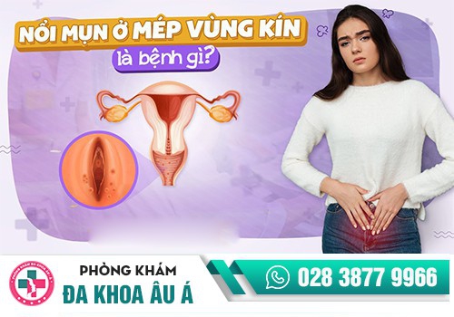 Nổi mụn ở môi lớn và môi bé âm đạo cảnh báo nguy hiểm 