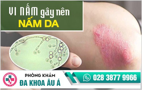 nấm da
