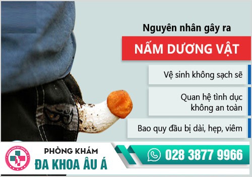 Nấm dương vật do nhiều nguyên nhân gây nên