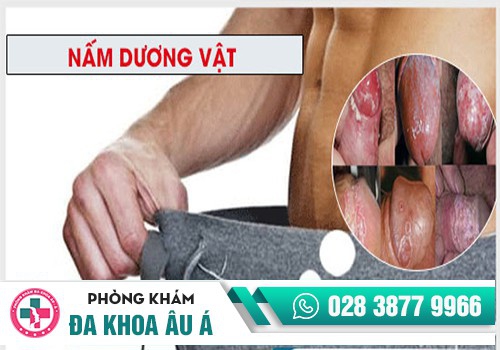 ĐAU BUỐT QUY ĐẦU LÀ DO ĐÂU?