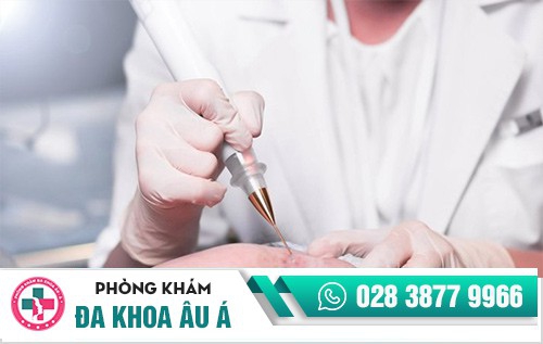 điều trị sùi mào gà ở đâu,trị sùi mào gà ở đâu uy tín, nên điều trị sùi mào gà ở đâu