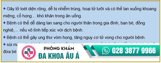 sùi mào gà ở lưỡi