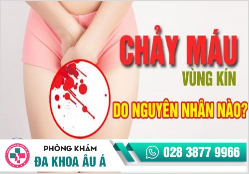 Chảy máu âm đạo - nguyên nhân và cách hỗ trợ điều trị