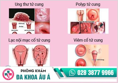 Nguyên nhân kinh nguyệt kéo dài là gì?