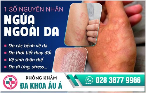 cách chữa ngứa da