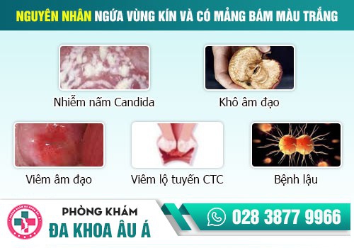 NGỨA RÁT ÂM ĐẠO LÀ DẤU HIỆU BỆNH GÌ?