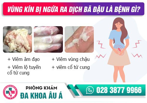 Nguyên nhân bị ngứa 2 bên mép vùng kín