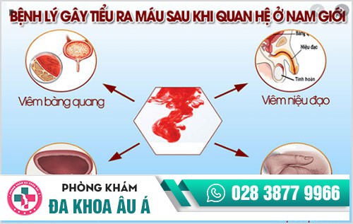 Tiểu buốt ra máu – coi chừng bệnh hiểm nghèo
