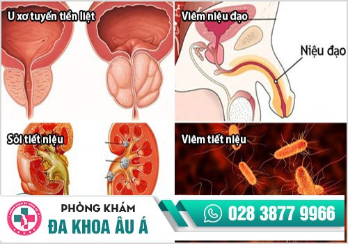 Các nguyên nhân dẫn đến tình trạng tiểu ra máu ở nam