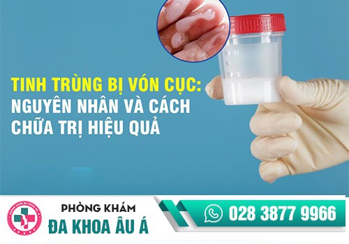 NHẬN BIẾT TÌNH TRẠNG TINH TRÙNG ĐẶC, TINH TRÙNG VÓN CỤC NHƯ THẾ NÀO?