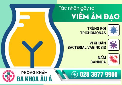 Nguyên nhân viêm nhiễm phụ khoa