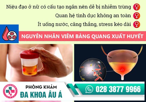 VIÊM BÀNG QUANG CÓ NGUY HIỂM KHÔNG?