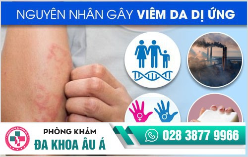 Viêm da dị ứng là gì? Cách điều trị bệnh hiệu quả