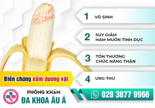 Bệnh nấm dương vật nguy hiểm như thế nào?