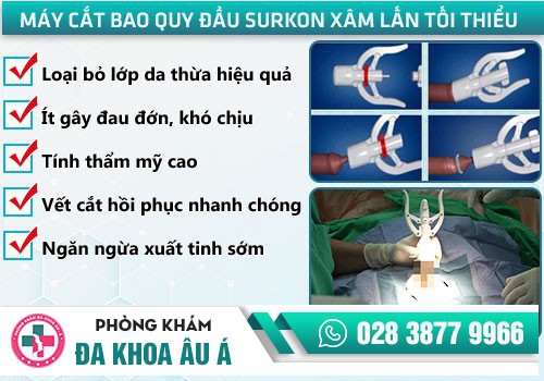 Phương pháp cắt bao quy đầu tiên tiến