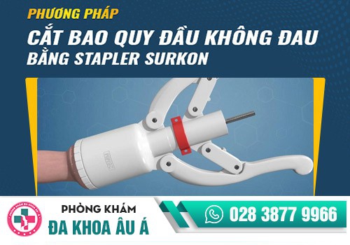 Phương pháp cắt bao quy đầu hiện nay