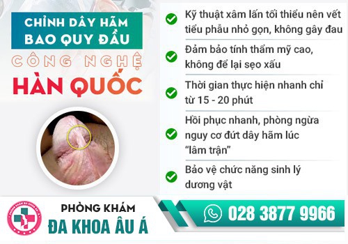 Phương pháp cắt dây hãm bao quy đầu an toàn