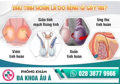 Xoắn tinh hoàn khiến nam giới bị đau 1 bên tinh hoàn