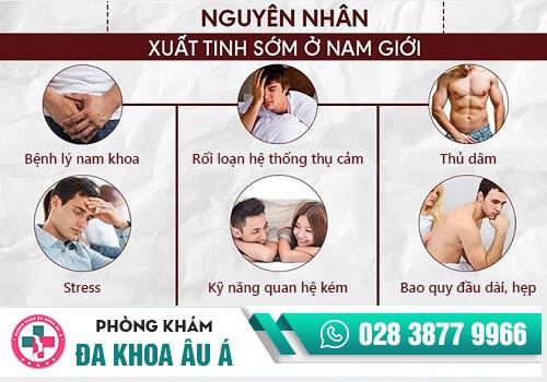 Các mức độ ra nhanh ở nam giới