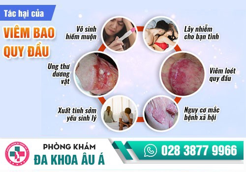  Các bệnh về bao quy đầu thường gặp ở nam giới.