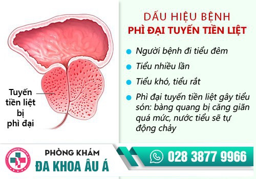 ĐAU TUYẾN TIỀN LIỆT DẤU HIỆU CỦA NHIỀU BỆNH LÝ NGUY HIỂM