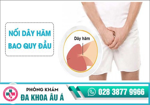 NHỮNG TRƯỜNG HỢP CẦN CAN THIỆP NỐI – KÉO DÀI DÂY HÃM BAO QUY ĐẦU