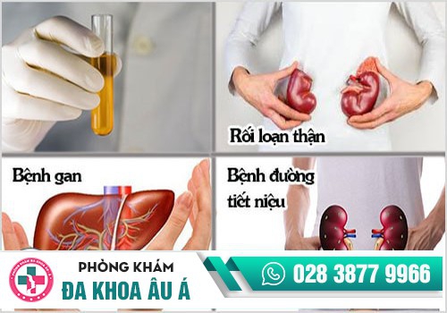 Nước tiểu màu vàng do một số bệnh lý