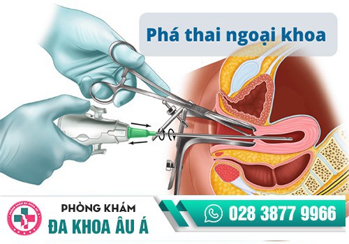 ƯU ĐIỂM PHƯƠNG PHÁP PHÁ THAI NGOẠI KHOA