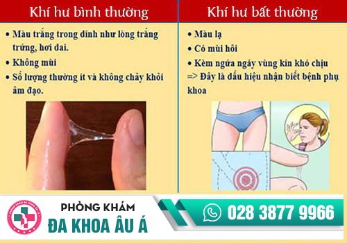KHÍ HƯ ĐẶC, KHÍ HƯ VÓN CỤC LÀ DẤU HIỆU BỆNH GÌ?