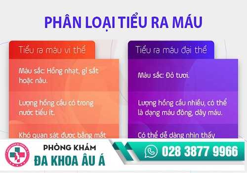 TIỂU RA MÁU Ở NAM – NGUYÊN NHÂN VÀ TÁC HẠI