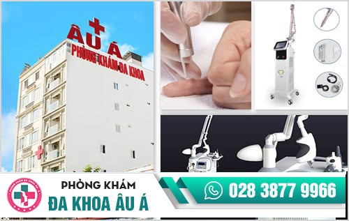 Phòng khám điều trị mụn cóc ở TP.HCM