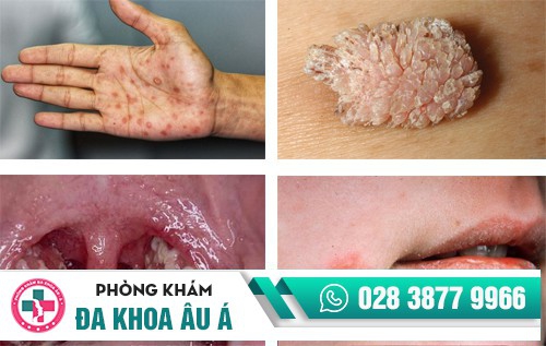 địa chỉ khám da liễu